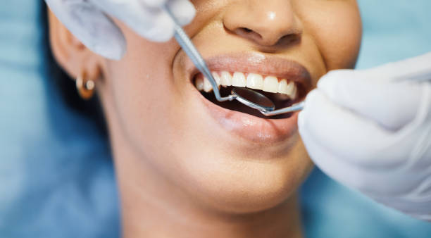 Best Urgent Tooth Repair  in Okanogan, WA