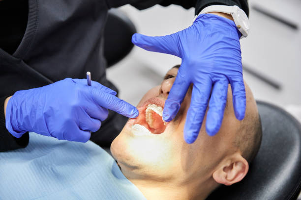 Best Knocked-Out Tooth Emergency  in Okanogan, WA